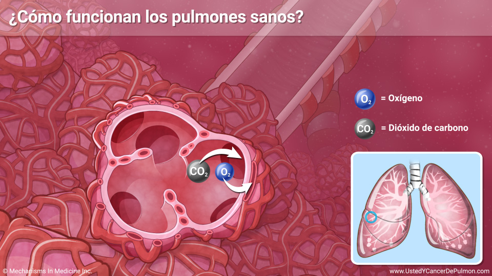 Presentaci N De Diapositivas Comprender El C Ncer De Pulm N De