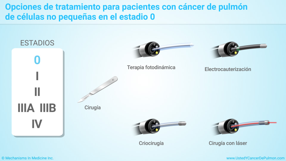 Presentación De Diapositivas - Tratamiento Y Manejo Del Cáncer De ...